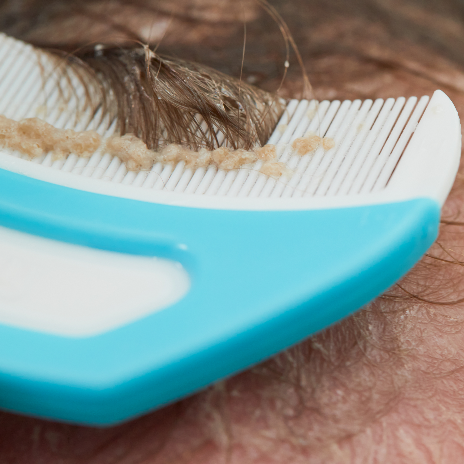 Bye bye croûtes de lait…